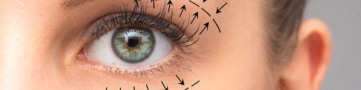 Blefaroplastia-Marbella-ClinicaPremium