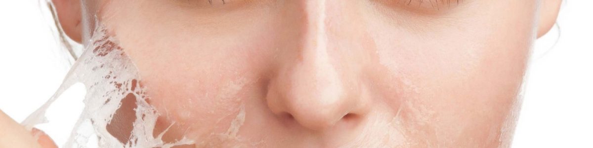 Peeling-Quimico-Facial-e1650116898491
